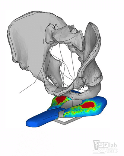 https://www.vojomag.com/app/uploads/2025/03/dossier peaux de chamois vojo romain viret 15.png